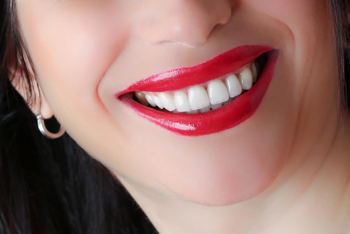 Custom smile design by Dr. Cvetan Mechev at La Mesa Dental Center
